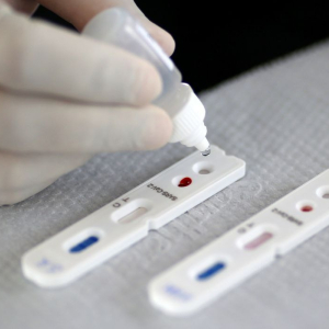 Pesquisadores desenvolvem testes rápidos para detectar coronavírus