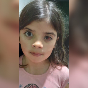 Família cria vaquinha para tratamento da pequena Emanuele