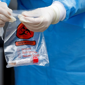 Tipo sanguíneo e genes estão ligados à covid-19 grave, mostra estudo
