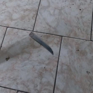 Homem arranca pedaço da orelha do próprio irmão com mordida em Mafra