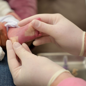 Santa Catarina amplia Teste do Pezinho que agora permite detecção da toxoplasmose
